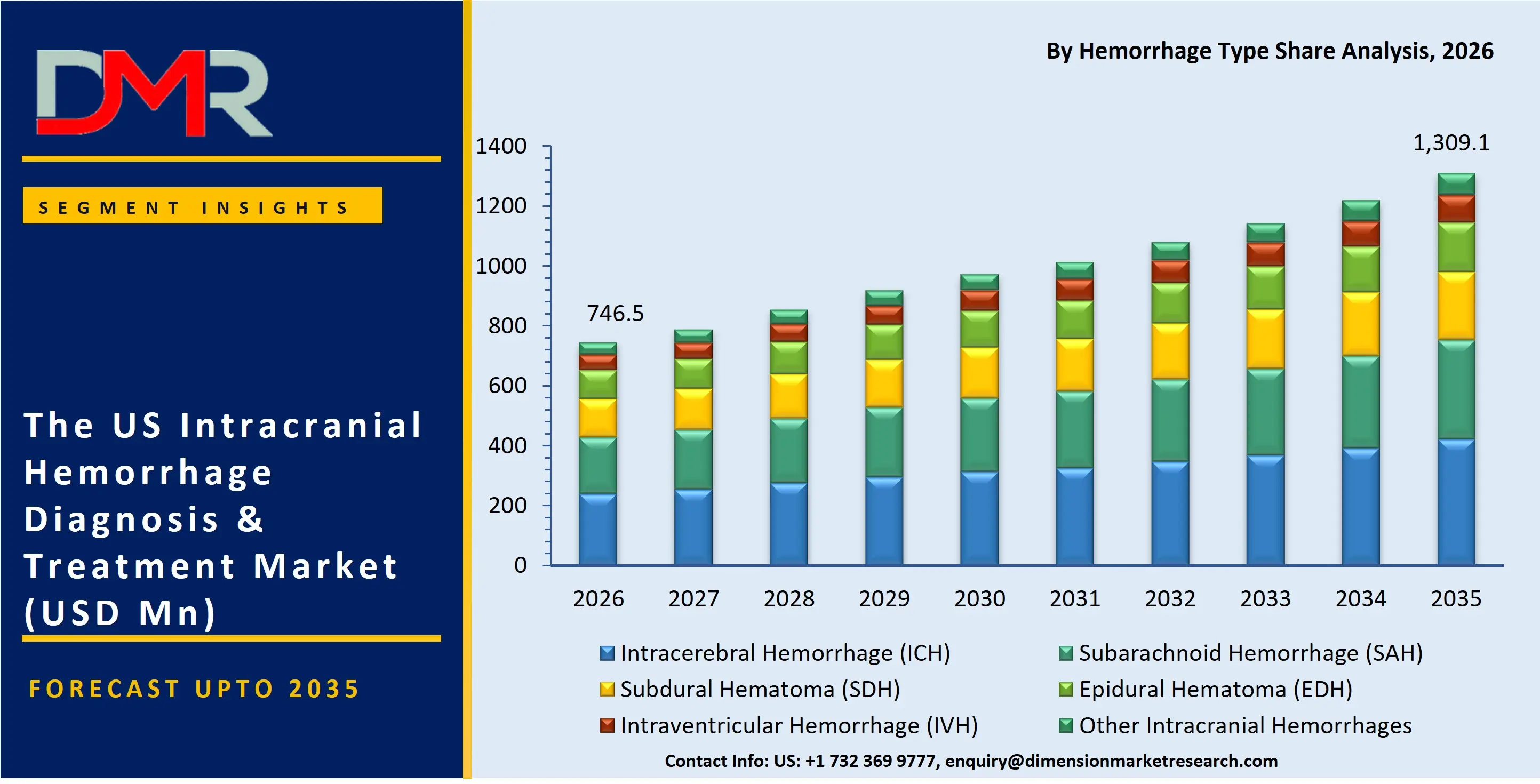 US Intracranial Hemorrhage Diagnosis & Treatment Market By Hemorrhage Type Share Analysis